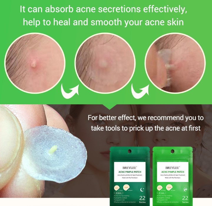 Tea Tree Acne Patch